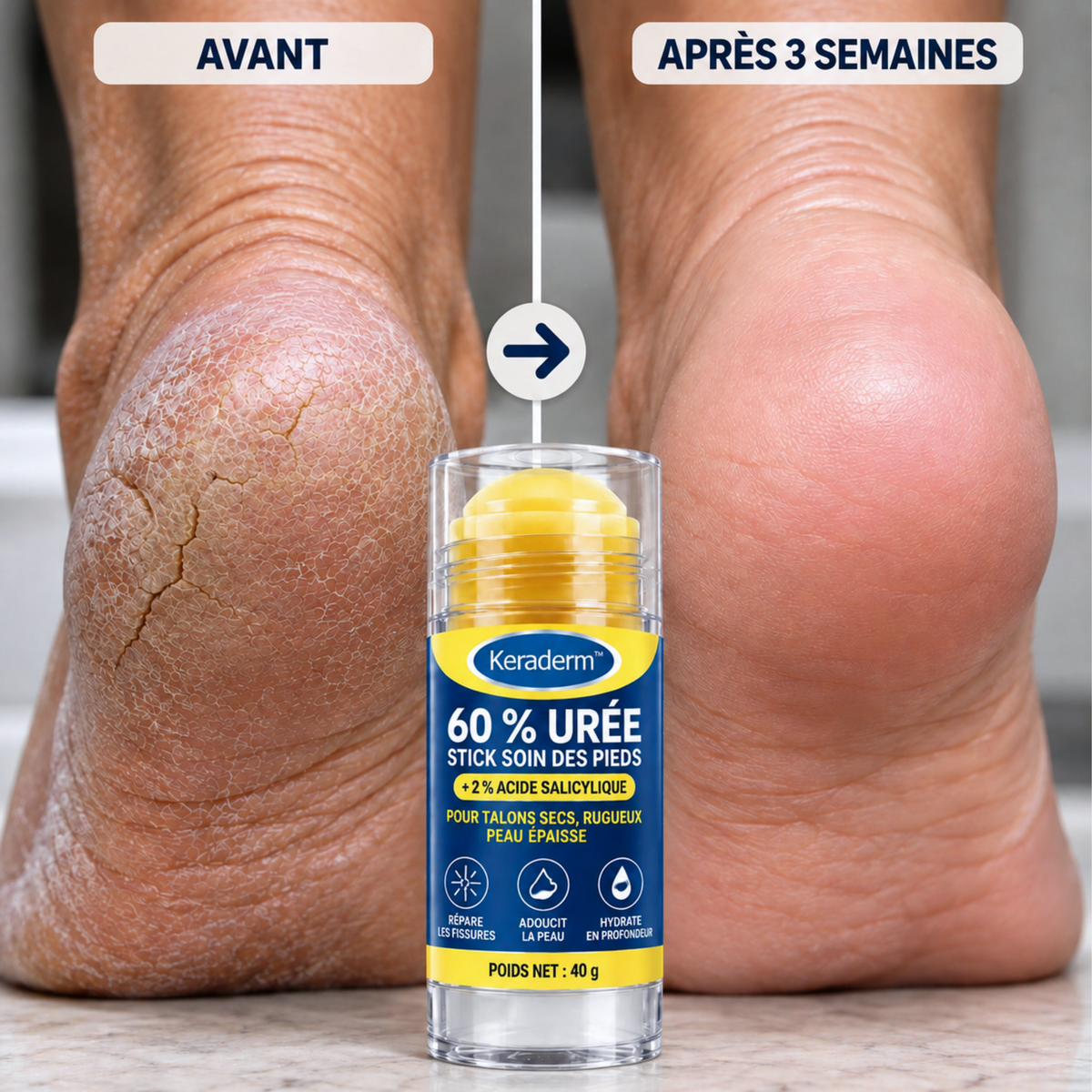 Stick Soin Hydratant Intensif Keraderm™