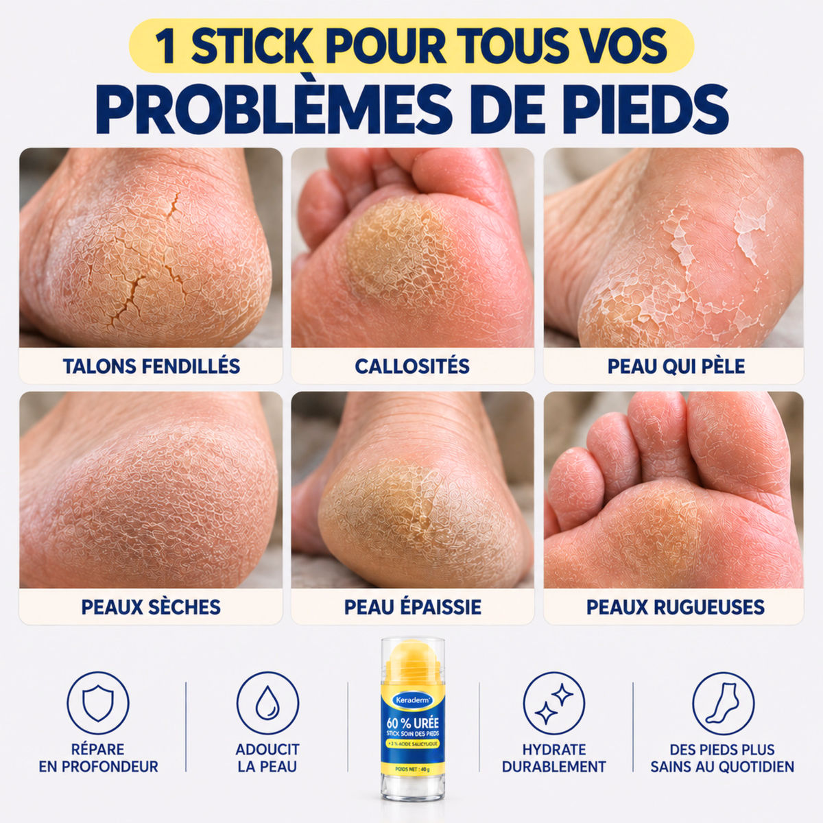 Stick Soin Hydratant Intensif Keraderm™